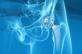 Understanding and Treating Hip Pain