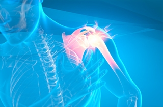 Shoulder Pain & Fractures
