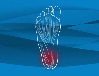 Plantar fasciitis-what you need to know. - Think Whole Person Healthcare